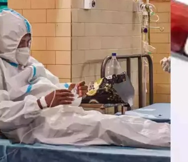 देश में पहली महिला जिसमें मिले मंकीपॉक्स के लक्षण